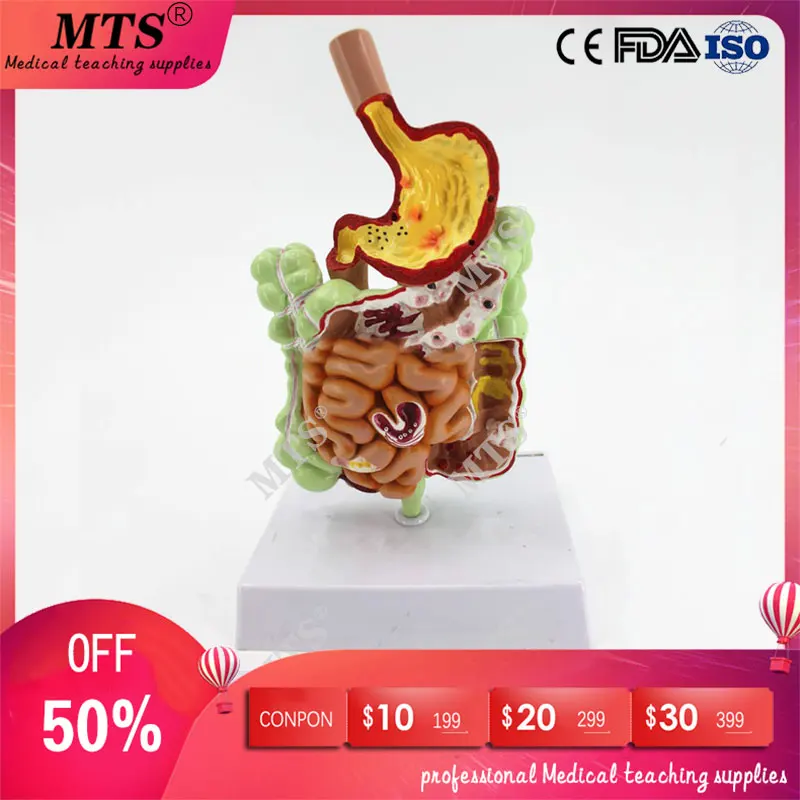 Human Gastrointestinal Pathology Anatomy Model Digestive Tract Gastric Coronal Section Transverse Colon Model medical teaching
Human Gastrointestinal Pathology Anatomy Model Digestive Tract Gastric Coronal Section Transverse Colon Model medical teaching