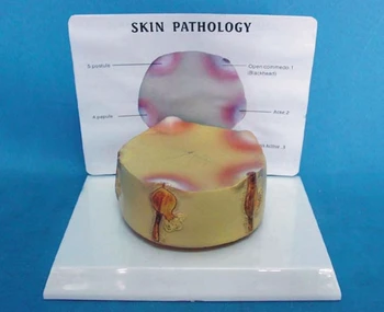 Human Skin Anatomical Magnification Model Skin Anatomy Model The Anatomy of The Skin Pathology Anatomy Medical Teaching Model
Human Skin Anatomical Magnification Model Skin Anatomy Model The Anatomy of The Skin Pathology Anatomy Medical Teaching Model