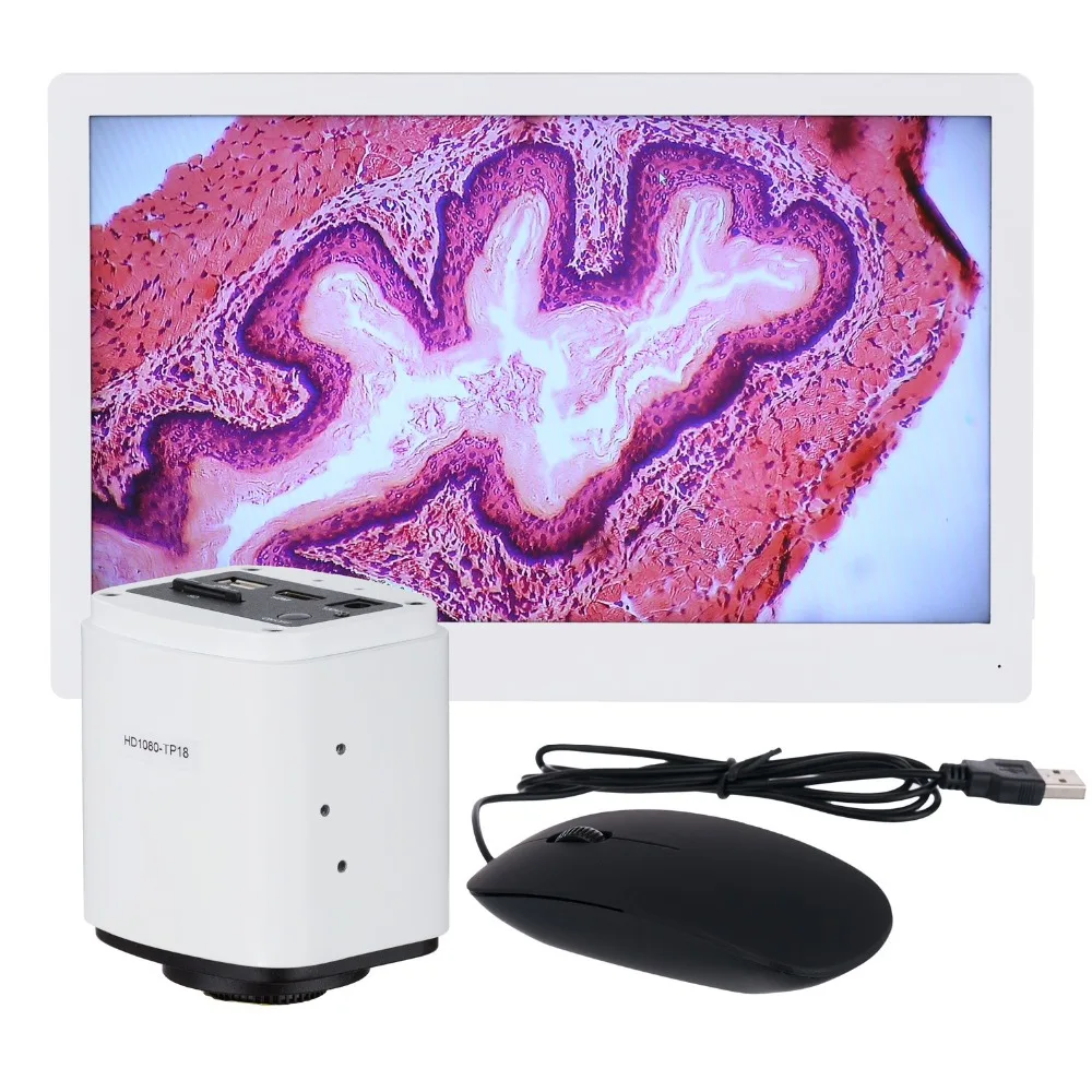 

AmScope 1080p 60fps HDMI Microscope Camera + HD Monitor HD1080-HDM