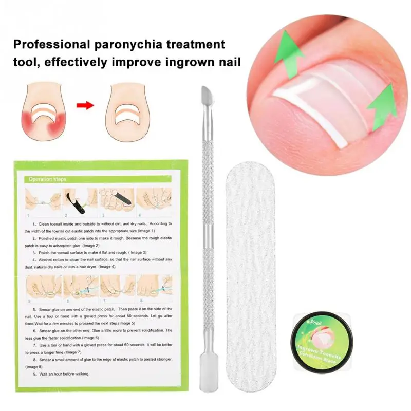 

4mm 12/ 24Pcs Professional Nail Correction Sticker Patch Foot Care Paronychia Correction File Elastic Patch Corrector Treatment