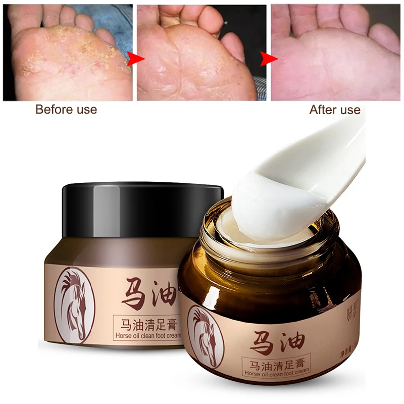 2018 Horse Oil Feet Cream for Athlete Feet Itch Blisters Anti-chapping Peeling Antibacterial Ointment
2018 Horse Oil Feet Cream for Athlete Feet Itch Blisters Anti-chapping Peeling Antibacterial Ointment