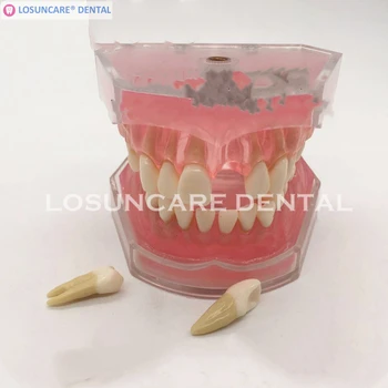2019 New Dental Standard Model with Removable Teeth Dental Study Teaching Teeth Model
2019 New Dental Standard Model with Removable Teeth Dental Study Teaching Teeth Model