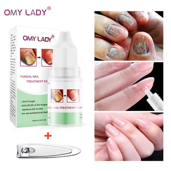 OMYLADY High Quality Nail Protector Skin Care ESSENCE Cream Nail Fungus Treatment Nails Repairing Cream Nail Care Tools
OMYLADY High Quality Nail Protector Skin Care ESSENCE Cream Nail Fungus Treatment Nails Repairing Cream Nail Care Tools