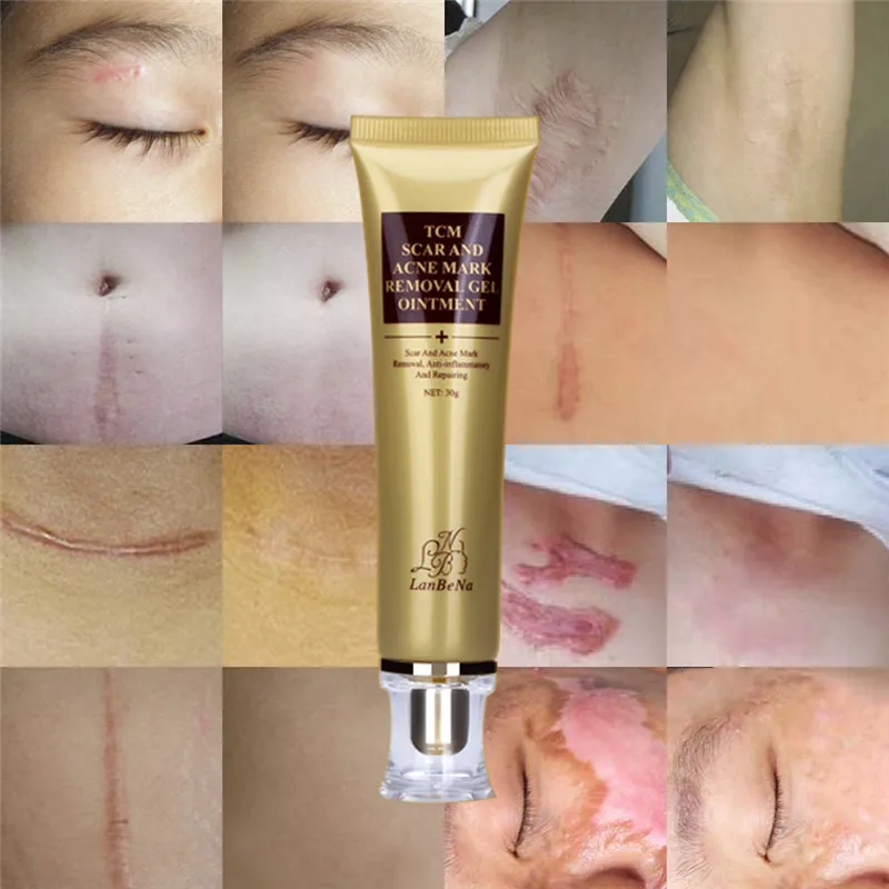 LANBENA-Acn-d-placement-de-Cicatrice-Cr-me-R-paration-de-La-Peau-Cr-me-Pour (3)_
