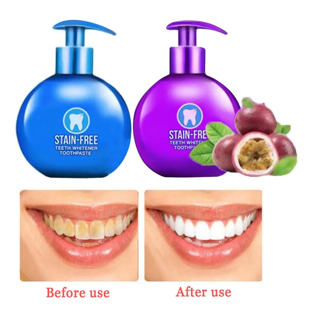 Fashion Pressing Design Toothpaste Fresh Breath Removing Smoke Stains Natural Brightening Teeth Whitening Toothpaste 220g 40P
Fashion Pressing Design Toothpaste Fresh Breath Removing Smoke Stains Natural Brightening Teeth Whitening Toothpaste 220g 40P