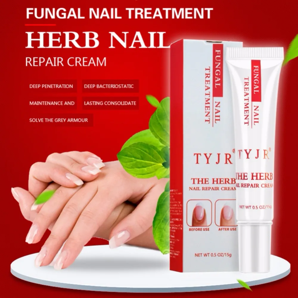 Fungal Nail Treatment for Toenails and Fingernails Nail Anti-Fungus Onychomycosis Rub Nails Repair Cream Nail Repair
Fungal Nail Treatment for Toenails and Fingernails Nail Anti-Fungus Onychomycosis Rub Nails Repair Cream Nail Repair