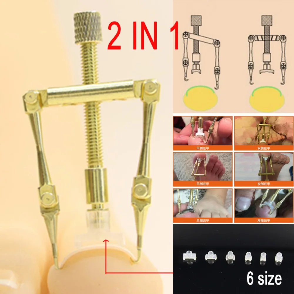 100% Copper 2 in 1 Ingrown Toe Nail Correction Fixer Tool for 1 OR 2 sides Ingrown toenails Pedicure NAIL Lifter File
100% Copper 2 in 1 Ingrown Toe Nail Correction Fixer Tool for 1 OR 2 sides Ingrown toenails Pedicure NAIL Lifter File