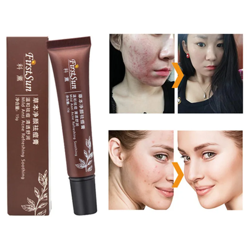 Firstsun 15g Acne Treatment Blackhead Remove Anti Acne Natural Plant Extract Cream Oil Control Acne Scar Remove Face Care TSLM2
Firstsun 15g Acne Treatment Blackhead Remove Anti Acne Natural Plant Extract Cream Oil Control Acne Scar Remove Face Care TSLM2