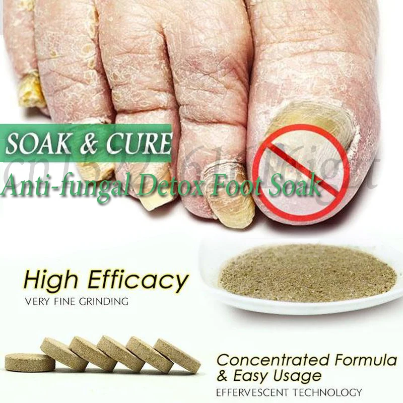 Fungal Nail Treatment Detox Foot Soak Long-Term Relief Athlete's Foot,Foot Skin Cracking,Psoriasis,Peeling,Beriberi
Fungal Nail Treatment Detox Foot Soak Long-Term Relief Athlete's Foot,Foot Skin Cracking,Psoriasis,Peeling,Beriberi