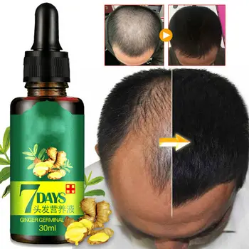 ReGrow - 7 Day Ginger Germinal Hair Growth Serum Essence Oil Hair Loss Building Loss Treatement Growth Hair for Men Women
ReGrow - 7 Day Ginger Germinal Hair Growth Serum Essence Oil Hair Loss Building Loss Treatement Growth Hair for Men Women