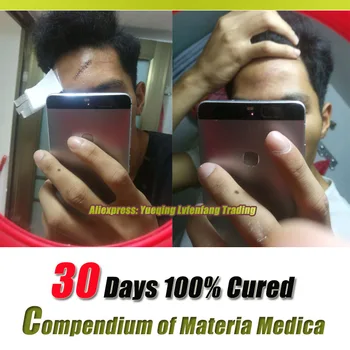 2pcs Acne Scar Removal Cream Skin Repair Face Cream Acne Spots Acne Treatment Blackhead Whitening Cream Anti Scar Stretch Marks
2pcs Acne Scar Removal Cream Skin Repair Face Cream Acne Spots Acne Treatment Blackhead Whitening Cream Anti Scar Stretch Marks