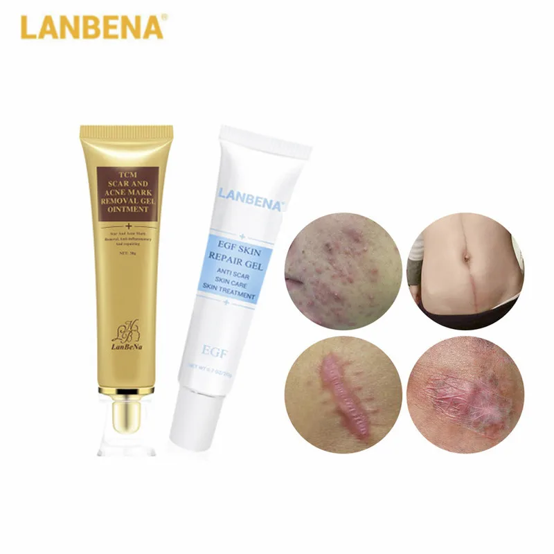 LANBENA 30g Acne Scar Removal Cream+20g Remover Scar Cream Repair Treatment Stretch Mark Scar Whitening Skin Care Face Cream
LANBENA 30g Acne Scar Removal Cream+20g Remover Scar Cream Repair Treatment Stretch Mark Scar Whitening Skin Care Face Cream