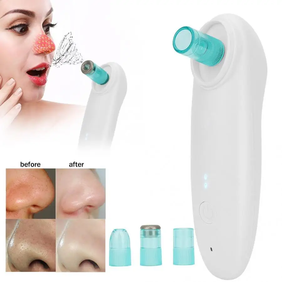 Powerful Vacuum Suction Blackhead Removal Face Pore Cleaner Skin Peeling Remove Dead Skin Beauty Device Machine
Powerful Vacuum Suction Blackhead Removal Face Pore Cleaner Skin Peeling Remove Dead Skin Beauty Device Machine