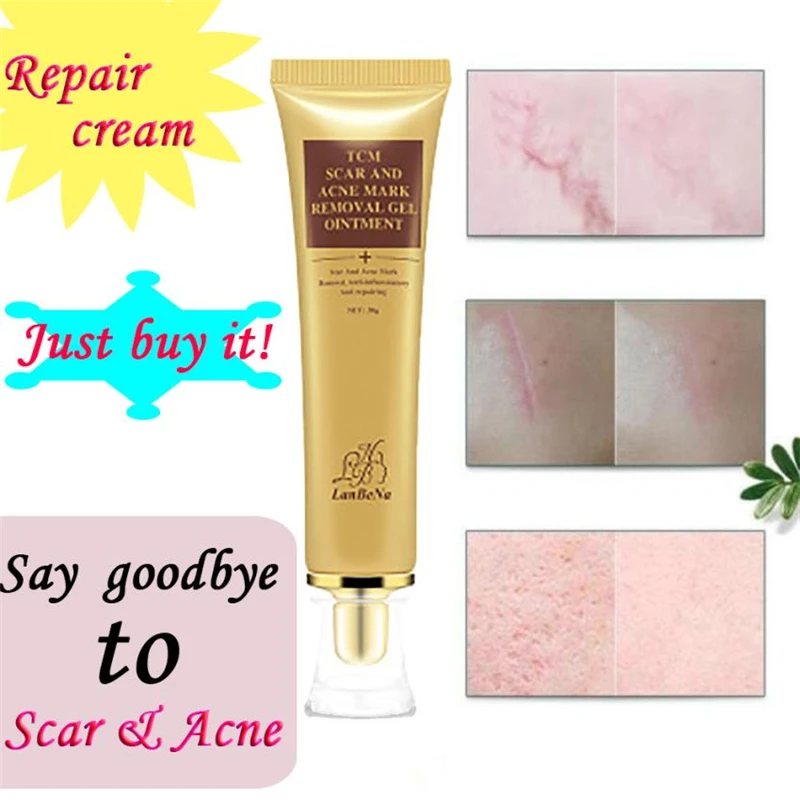 Dropshipping Cheapest 30ml Acne Scar Removal Cream Skin Repair Face Cream Acne Spot Acne Removal Cream Profissional Maquiagem
Dropshipping Cheapest 30ml Acne Scar Removal Cream Skin Repair Face Cream Acne Spot Acne Removal Cream Profissional Maquiagem