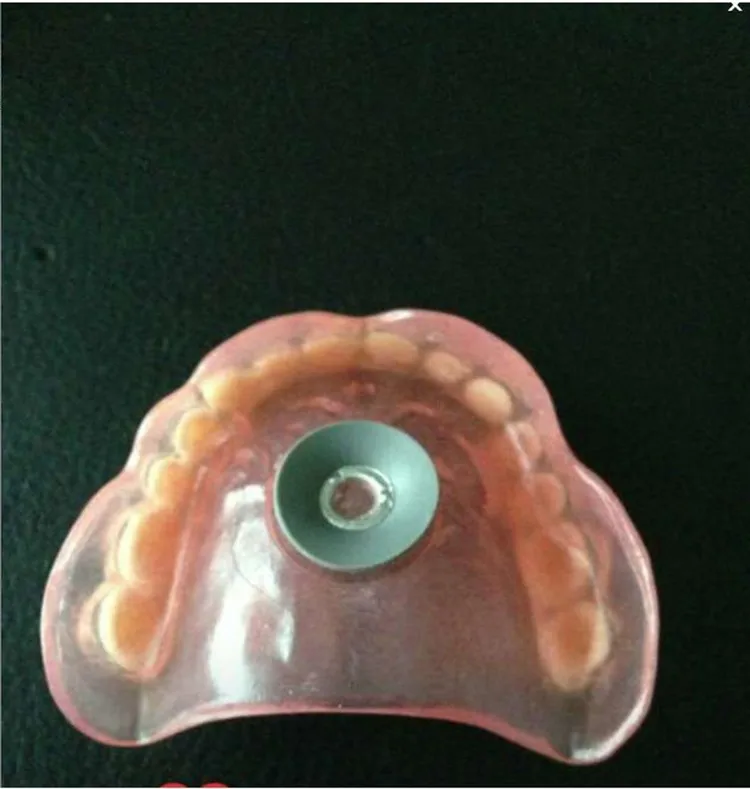 Полный бюгельного протеза - найдено 85 картинок