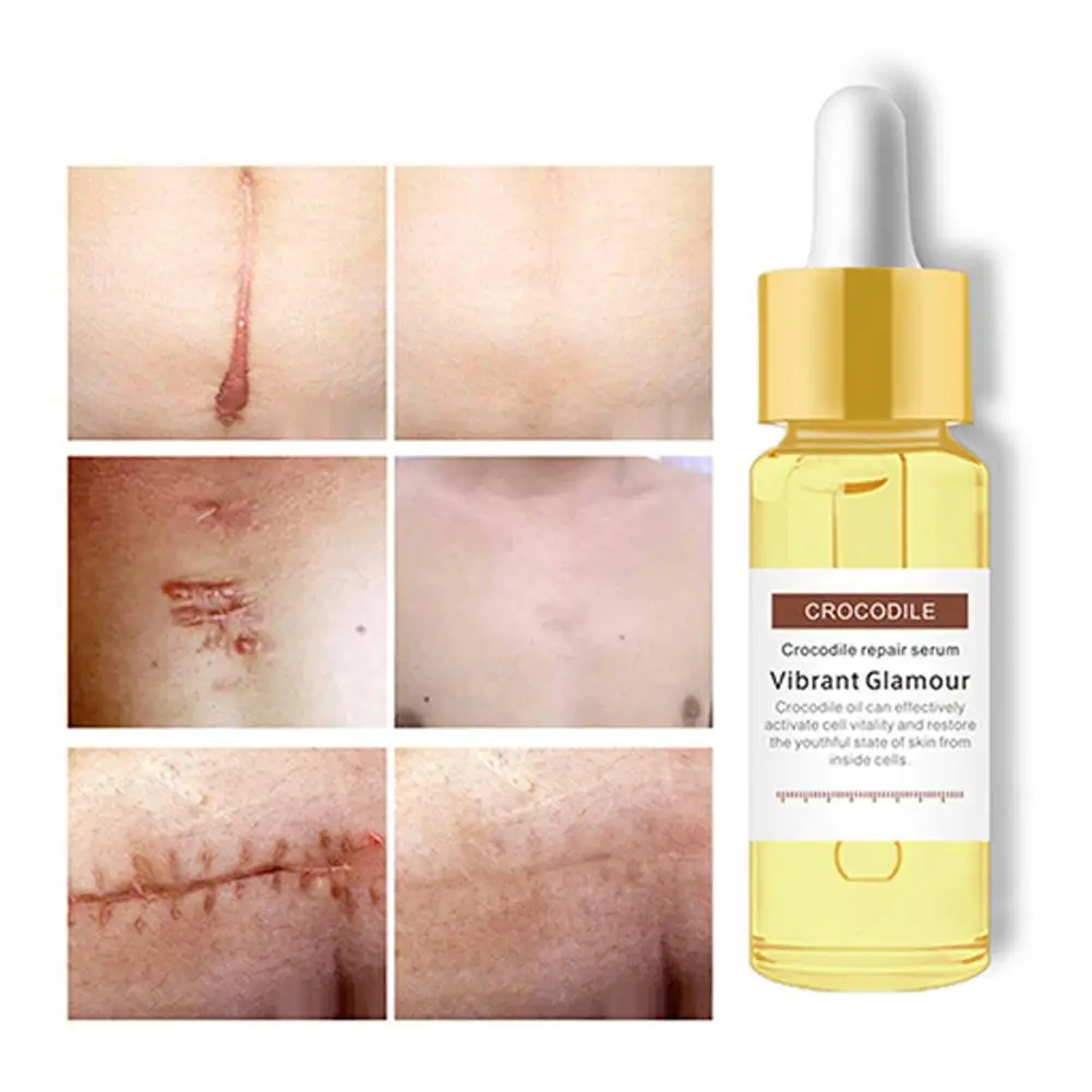 Crocodile Repairing Scar Essence Acne Faded Acne Marks Remove Brighten Skin Care 15ML
Crocodile Repairing Scar Essence Acne Faded Acne Marks Remove Brighten Skin Care 15ML