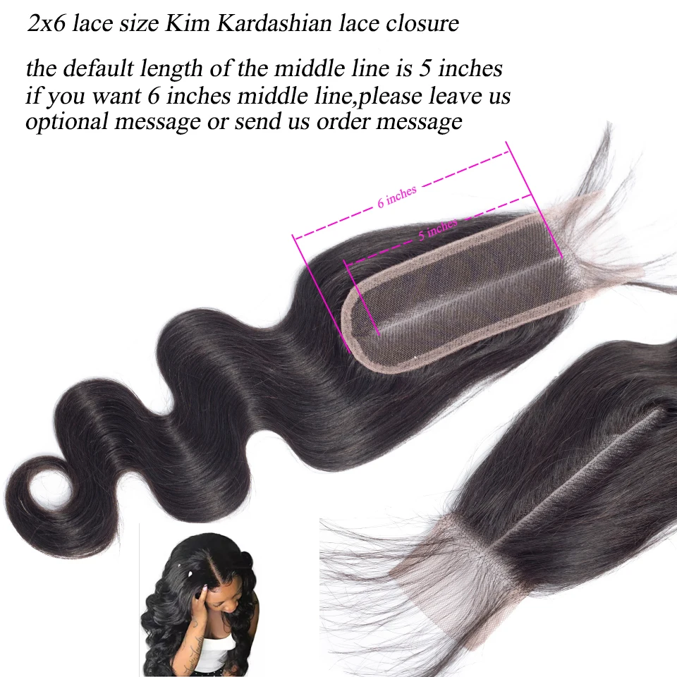 bundles with closure 14