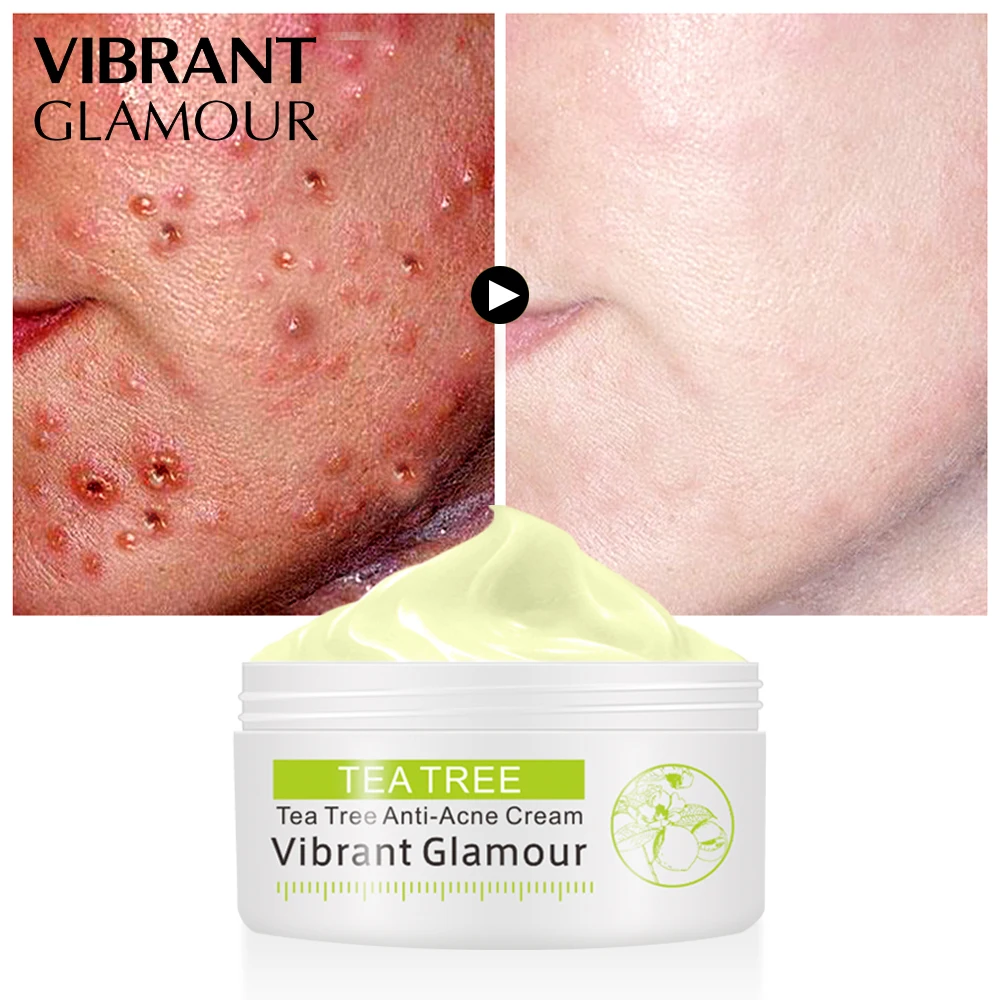 VIBRANT GLAMOUR Tea Tree Anti-Acne Face Cream Oil Control Shrink Pores Acne Cream Nourish Whitening Acne Scar Remove Skin Care
VIBRANT GLAMOUR Tea Tree Anti-Acne Face Cream Oil Control Shrink Pores Acne Cream Nourish Whitening Acne Scar Remove Skin Care