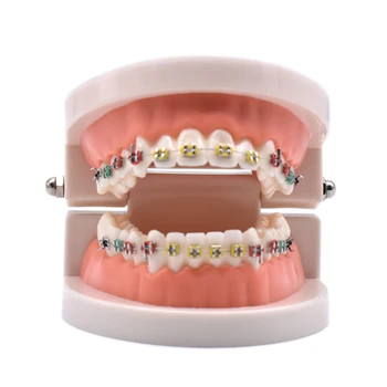 Dental Orthodontic Treatment Model With Ortho Metal Ceramic Bracket Arch Wire Buccal Tube Ligature Ties Dental Tools Dentist Lab
Dental Orthodontic Treatment Model With Ortho Metal Ceramic Bracket Arch Wire Buccal Tube Ligature Ties Dental Tools Dentist Lab