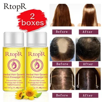 2PC 20ml/bottle Fast Hair Growth Essence Liquid Natural Hair Loss Treatment Liquid Development of Hair Cream 100% High Quality
2PC 20ml/bottle Fast Hair Growth Essence Liquid Natural Hair Loss Treatment Liquid Development of Hair Cream 100% High Quality