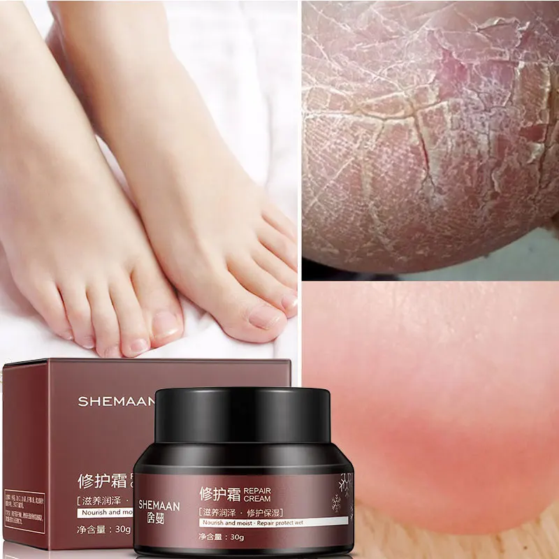 30g Vaseline Prevent Skin Crack Repair Cream Dry Skin Moisturizing Crack Heel Cream Deep Nourishing Creams Treatment Cracking
30g Vaseline Prevent Skin Crack Repair Cream Dry Skin Moisturizing Crack Heel Cream Deep Nourishing Creams Treatment Cracking