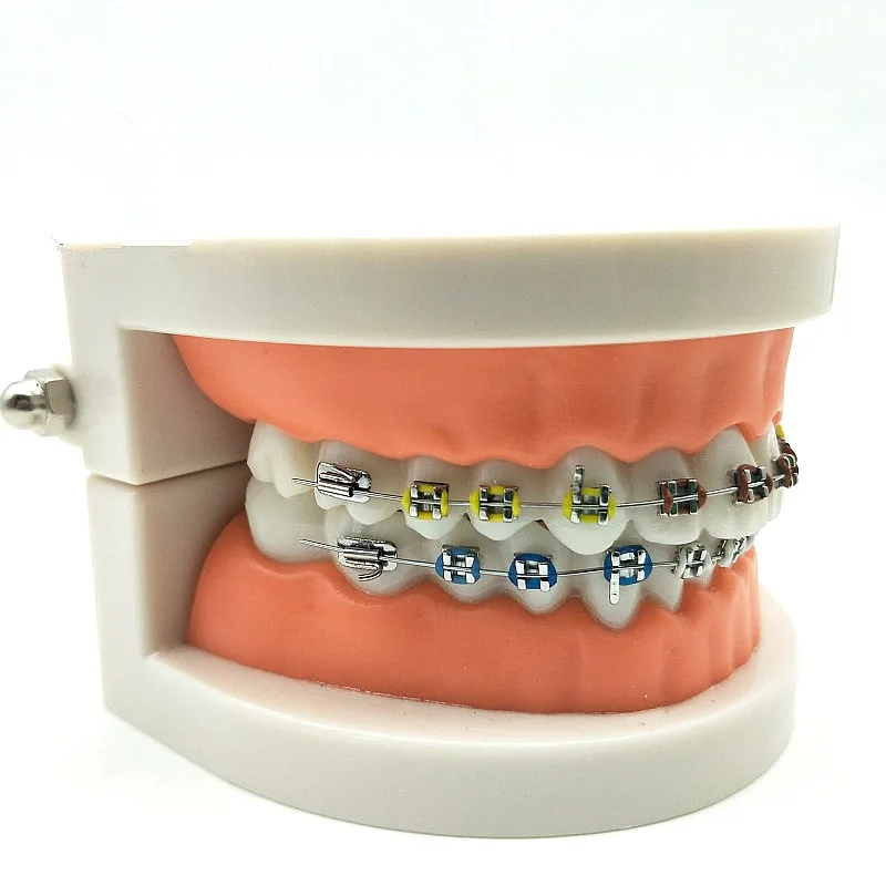 1 Pcs Dental Orthodontic Treatment Model With Ortho Metal Ceramic Bracket Arch Wire Buccal Tube Ligature Ties
1 Pcs Dental Orthodontic Treatment Model With Ortho Metal Ceramic Bracket Arch Wire Buccal Tube Ligature Ties