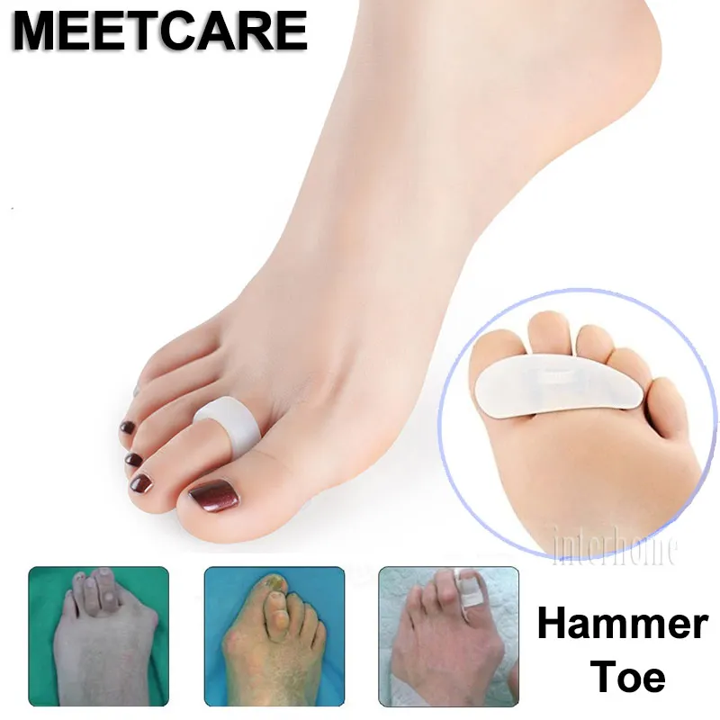 Meetcare Hammer Toe Orthotics Hallux valgus Bunion or Mallet Toes Silicon Separator Deformity Correction Foot Pain Relief
Meetcare Hammer Toe Orthotics Hallux valgus Bunion or Mallet Toes Silicon Separator Deformity Correction Foot Pain Relief