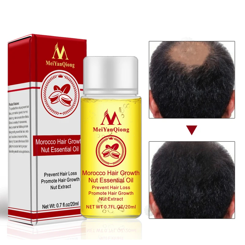 20ml Prevention Hair Loss Essential Nut Hair Care Growth Liquid Hair Nourishing Care Essence Hair Growth Oil TSLM1
20ml Prevention Hair Loss Essential Nut Hair Care Growth Liquid Hair Nourishing Care Essence Hair Growth Oil TSLM1