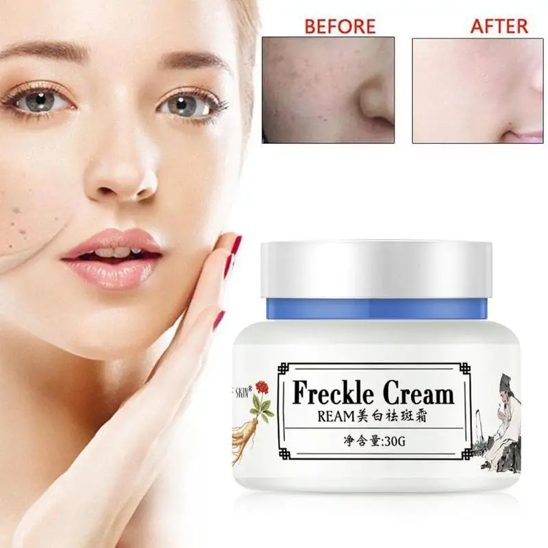 Strong Effects Freckle Cream Powerful Whitening Remove Melasma Acne Spots Pigment Melanin Dark Spots Moisturing Face Care Cream
Strong Effects Freckle Cream Powerful Whitening Remove Melasma Acne Spots Pigment Melanin Dark Spots Moisturing Face Care Cream