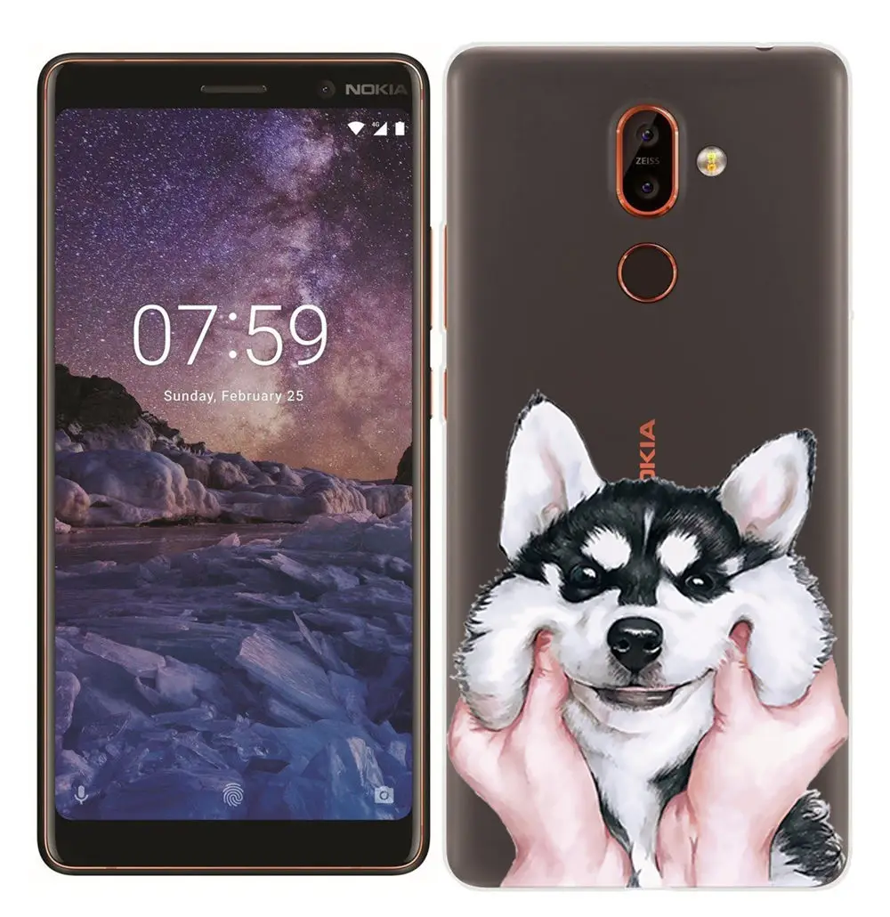 Soft TPU Case for Nokia 7 Plus Smart Back Cover for Nokia 3 5 6 7 8 Painted ShockProof Fundas for Nokia 2.1 3.1 5.1 6.1 Silicone (4)