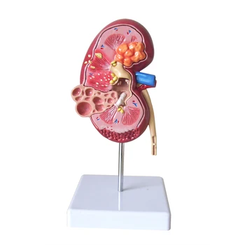 Lesion Kidney Model Human Anatomy Organ Medical Teaching Supplies
Lesion Kidney Model Human Anatomy Organ Medical Teaching Supplies