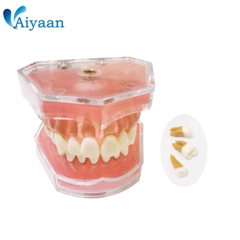 1 Pc Detachable Soft Teeth Model for Teaching & Learning/Demo/Mouth Model Teeth-brush Teaching Model
1 Pc Detachable Soft Teeth Model for Teaching & Learning/Demo/Mouth Model Teeth-brush Teaching Model