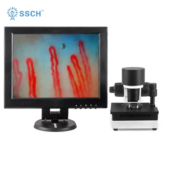 blood capillary microcirculation microscope for detect body health
blood capillary microcirculation microscope for detect body health