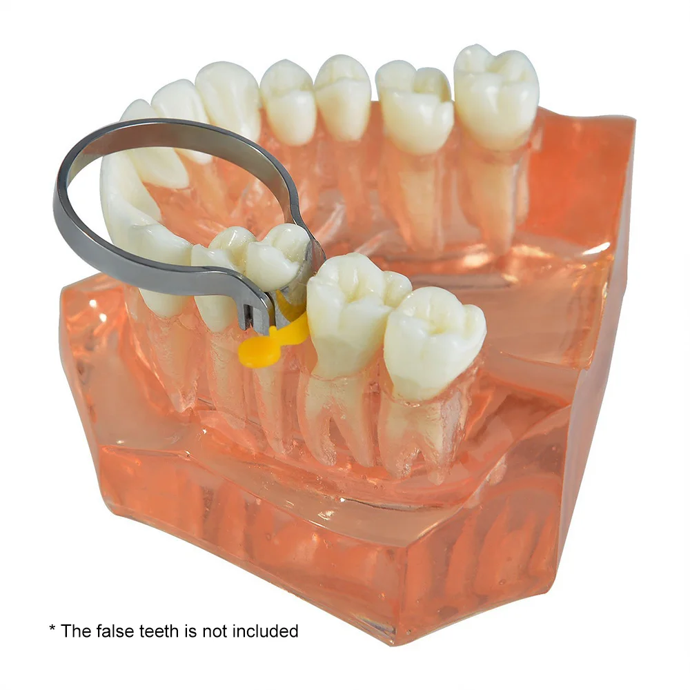 100Pcs Full Dental Sectional Contoured Matrices Matrix Ring Kit Dental Orthodontic Metal Matrices With 2 Rings Hard
100Pcs Full Dental Sectional Contoured Matrices Matrix Ring Kit Dental Orthodontic Metal Matrices With 2 Rings Hard