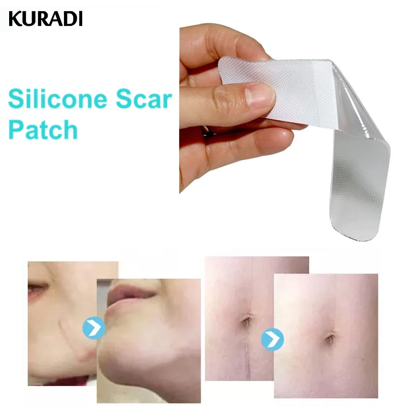 Washable Silicone Scar Therapy Sticker Remove Trauma Burn Silicon Patch Reusable Acne Gel Skin Caesarean Section Surgery Repair
Washable Silicone Scar Therapy Sticker Remove Trauma Burn Silicon Patch Reusable Acne Gel Skin Caesarean Section Surgery Repair
