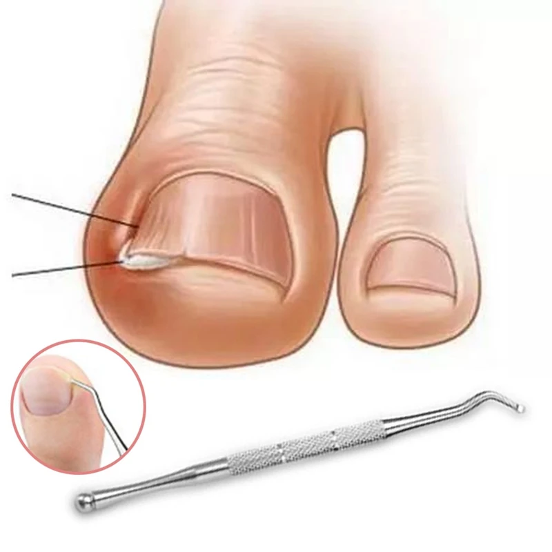 Dual-ended Nail Cuticle Remover Pusher Tool Stainless Steel Groove Corrector Manicure Nail Art Pedicure Tool Kit Paronychia Tool
Dual-ended Nail Cuticle Remover Pusher Tool Stainless Steel Groove Corrector Manicure Nail Art Pedicure Tool Kit Paronychia Tool
