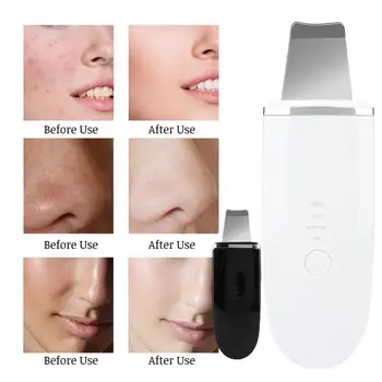 High-end Wireless Charging Ultrasonic Vibration Skin Scrubber Blackhead Cutin Cleansing Spatula a
High-end Wireless Charging Ultrasonic Vibration Skin Scrubber Blackhead Cutin Cleansing Spatula a