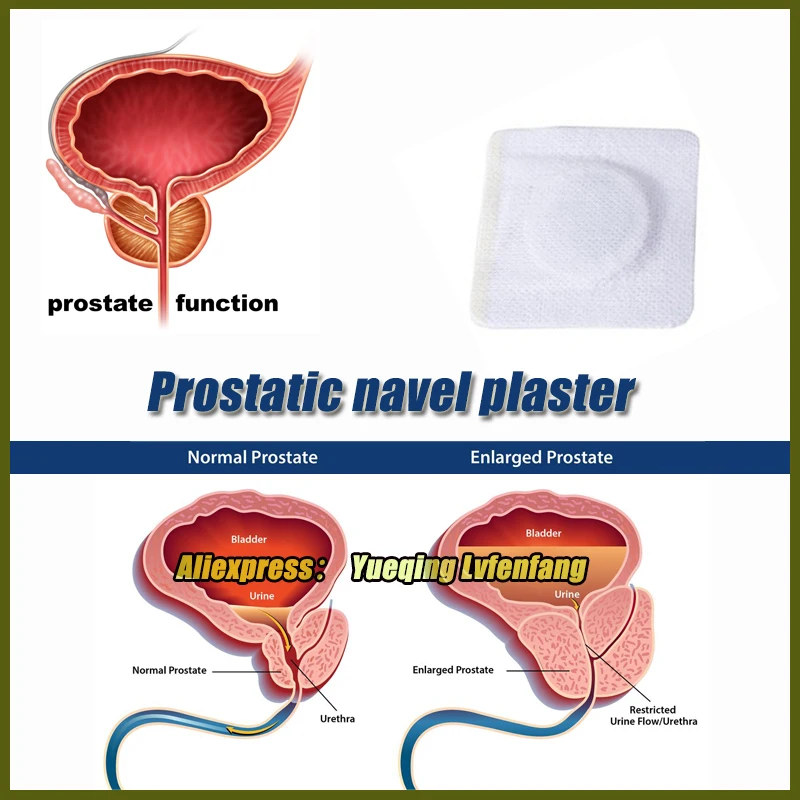 20pcs herbs Prostatic navel plaster prostatitis urology patch urological plaster prostatitis Chinese herbal herbal patch
20pcs herbs Prostatic navel plaster prostatitis urology patch urological plaster prostatitis Chinese herbal herbal patch