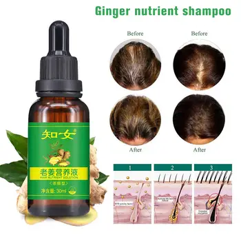 Ginger Nutrition Shampoo Multi-function Nourishing Repair Hair Hair Loss Fast and Powerful Hair Growth Essence Repair Hair Root
Ginger Nutrition Shampoo Multi-function Nourishing Repair Hair Hair Loss Fast and Powerful Hair Growth Essence Repair Hair Root