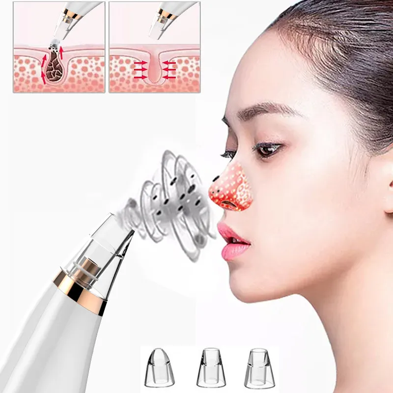Vacuum Facial Instrument Blackheads Remover Skin Care,Pore Cleaner Blackheads Electric Acne Clean Exfoliating Cleansing Face
Vacuum Facial Instrument Blackheads Remover Skin Care,Pore Cleaner Blackheads Electric Acne Clean Exfoliating Cleansing Face