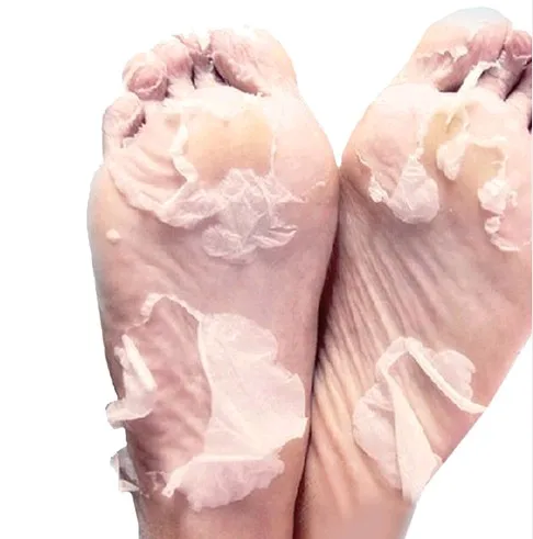 6 bags/lot Japanese Foot Mask Socks For Pedicure Exfoliating Spa Socks For Heels Feet Whitening Foot Care Tool
6 bags/lot Japanese Foot Mask Socks For Pedicure Exfoliating Spa Socks For Heels Feet Whitening Foot Care Tool