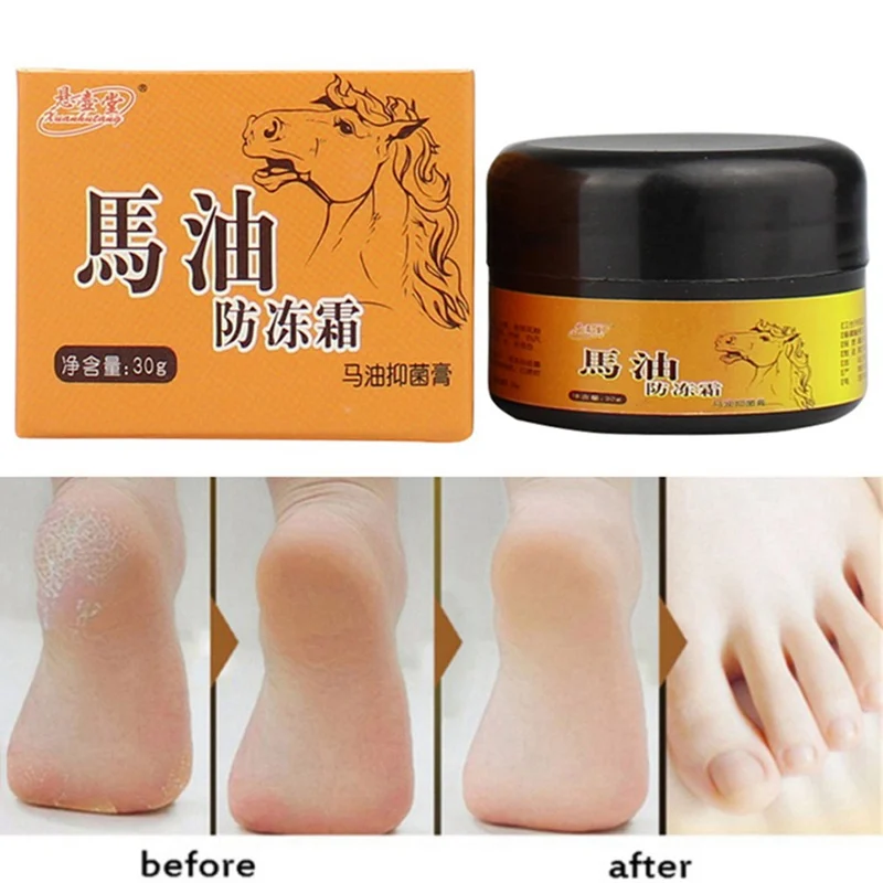 30g Horse Oil Foot Cream Anti-Chapping Skin Repairing Moisturizer For Rough Dry And Cracked Chapped Feet Heel
30g Horse Oil Foot Cream Anti-Chapping Skin Repairing Moisturizer For Rough Dry And Cracked Chapped Feet Heel
