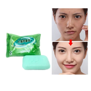 Sale! 100% best-quality 2019 NEW Shanghai Aloe Soap Skin Conditions Acne Psoriasis Seborrhea Eczema Anti Fungus 85g
Sale! 100% best-quality 2019 NEW Shanghai Aloe Soap Skin Conditions Acne Psoriasis Seborrhea Eczema Anti Fungus 85g