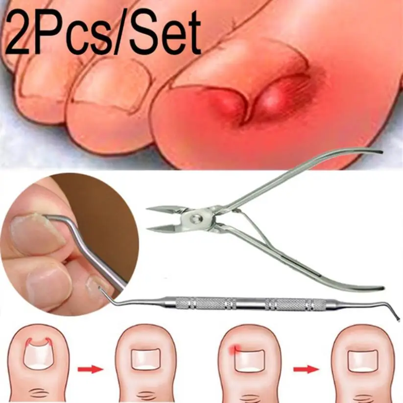2Pcs/Set Ingrown Toe Nail Correction Nippers Clipper Cutters Dead Skin Dirt Remover + Paronychia Podiatry Pedicure Care Tool 06.
2Pcs/Set Ingrown Toe Nail Correction Nippers Clipper Cutters Dead Skin Dirt Remover + Paronychia Podiatry Pedicure Care Tool 06.