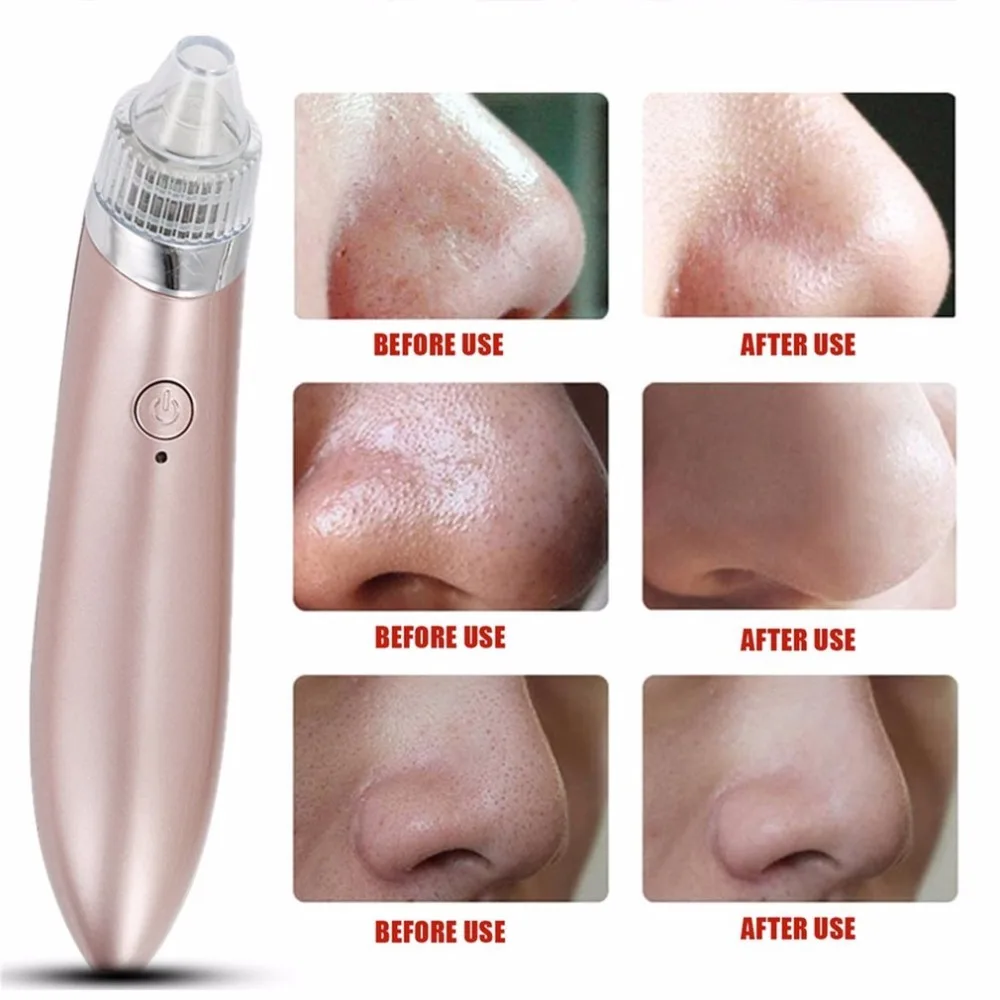 Electric Facial Blackhead Remove Machine Vacuum Acne Cleaner Pore Remover Electric Skin Facial Cleanser Care Pore Peeling Tool
Electric Facial Blackhead Remove Machine Vacuum Acne Cleaner Pore Remover Electric Skin Facial Cleanser Care Pore Peeling Tool