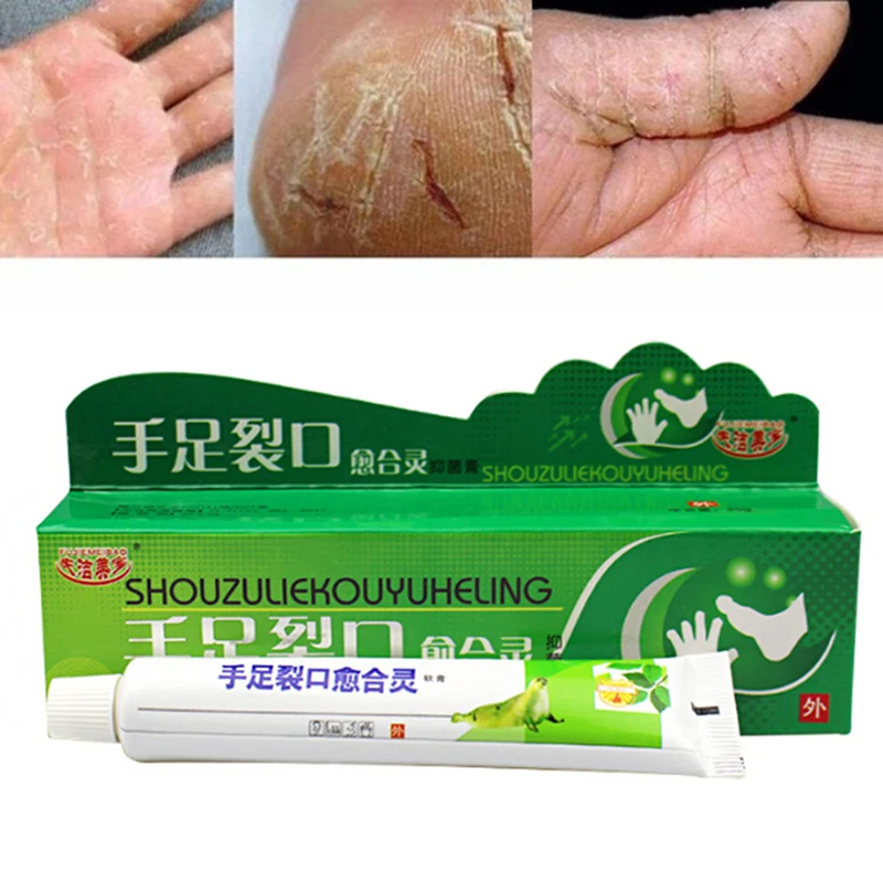 Powerful Hand Foot Crack Cream Heel Chapped Peeling Foot And Hand Repair Anti Dry Crack Skin Care Chinese Ointment Top Selling
Powerful Hand Foot Crack Cream Heel Chapped Peeling Foot And Hand Repair Anti Dry Crack Skin Care Chinese Ointment Top Selling