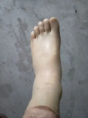 1(8)