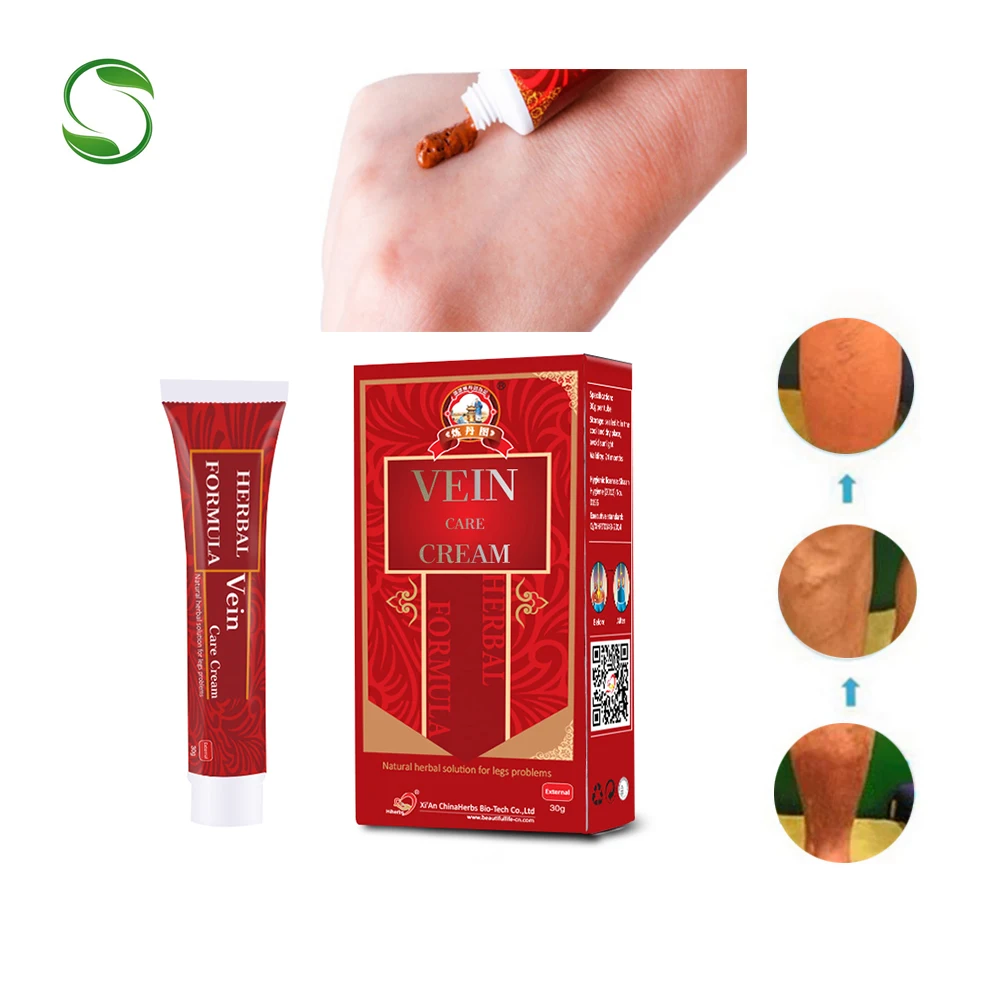 2pcs Varicose Veins Treatment Cream Effective cure Vasculitis Phlebitis Spider Veins Pain Varicosity Angiitis ointment
2pcs Varicose Veins Treatment Cream Effective cure Vasculitis Phlebitis Spider Veins Pain Varicosity Angiitis ointment