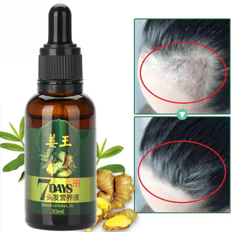 Hair Growth Essence Ginger Natural Plant Extract Anti Hair Loss Treatment Liquid Pilatory
Hair Growth Essence Ginger Natural Plant Extract Anti Hair Loss Treatment Liquid Pilatory