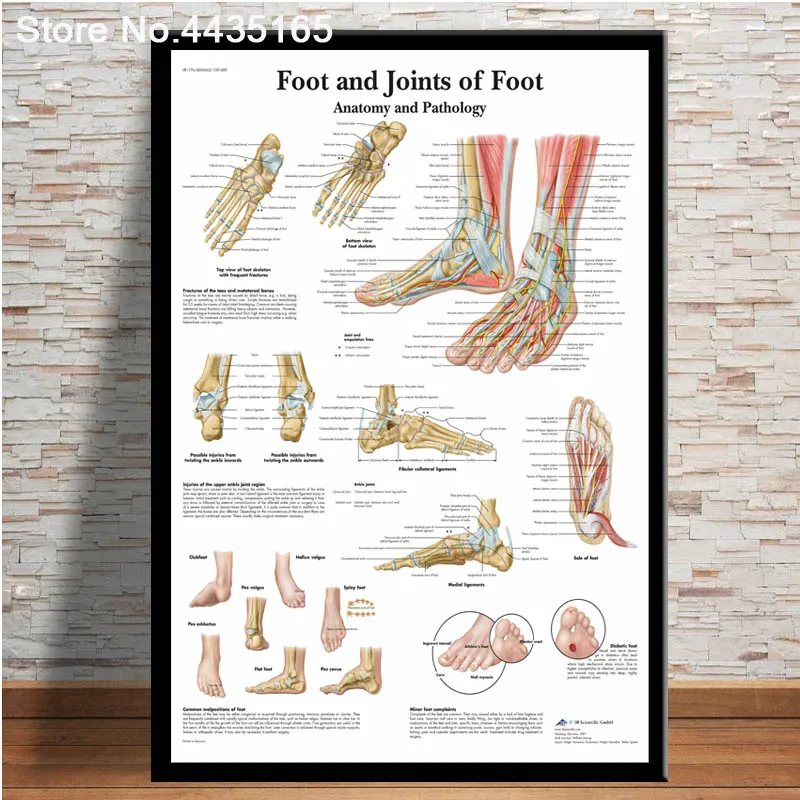 Joint Chart Anatomy